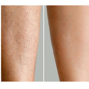 Visibly Clearer, Smoother Skin